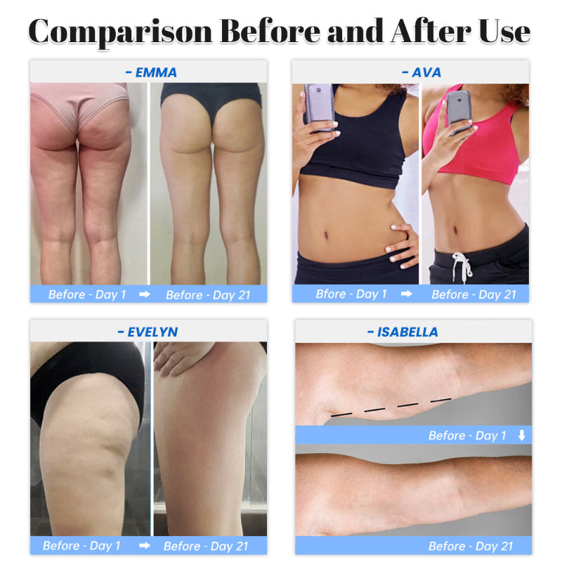 3 in 1 Cupping, Scraping & Massage Device