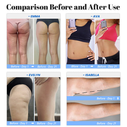 3v1 přístroj na baňkování, škrábání a masáž