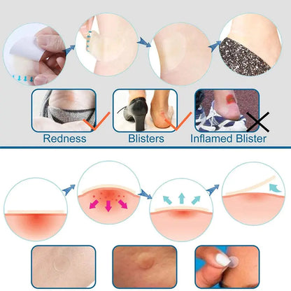 Různé voděodolné hydrokolloidní náplasti na puchýře na nohy